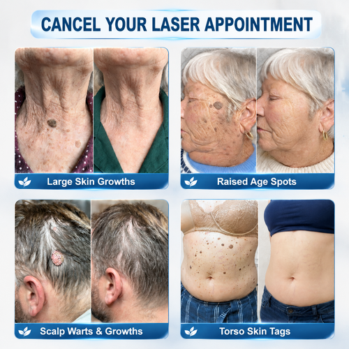 𝘿𝙖𝙧𝙠𝙁𝙖𝙞𝙧𝙮™👩‍⚕️ 𝟕-𝐃𝒂𝘆 𝐒𝗸𝐢𝐧 𝐓𝒂𝗴 & 𝐒𝐩𝙤𝐭 𝐄𝐫𝒂𝐬𝙚𝐫 Painless & Scar-Free Advanced Imperfection Removal Rollerball Pen